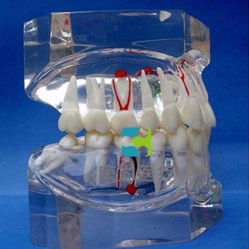 “康為醫療”透明牙體病理模型