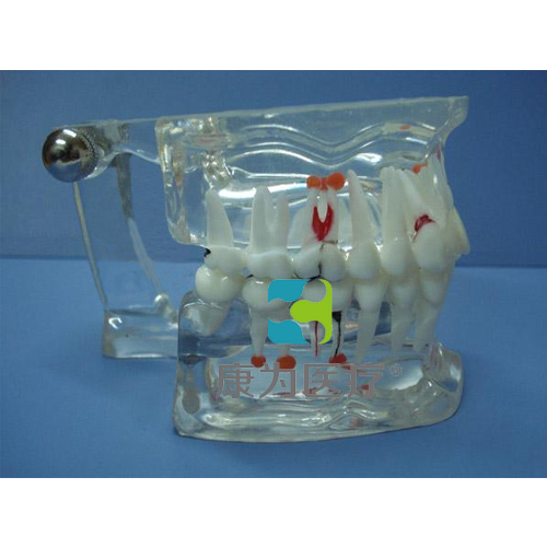 “康為醫療”綜合病理水晶牙列模型(28顆牙)