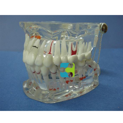 “康為醫療”綜合病理水晶牙列模型(32顆牙)