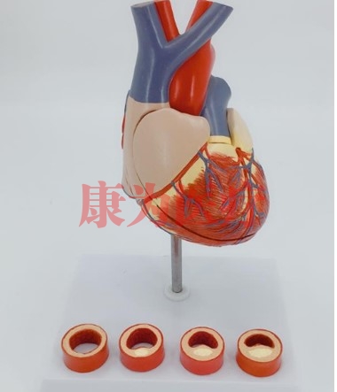 “康為醫療”病態血管心臟演示模型